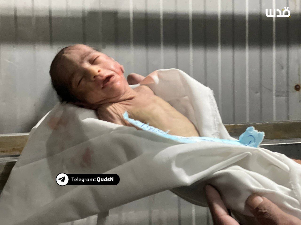 شهادت نوزاد یک ماهه در نوار غزه بهعلت سرمای شدید+ عکس شهادت نوزاد یک ماهه در نوار غزه بهعلت سرمای شدید+ عکس