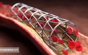 خوش به حالِ بیماران قلبی شد خوش به حالِ بیماران قلبی شد