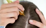 تکنیک ژاپنی ‎ها برای رشد انفجاری موها لو رفت