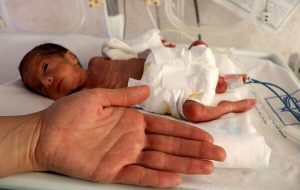 ترخیص نوزاد ۷۰۰ گرمی پس از ۴۸ روز تلاش شبانه‌روزی کادر درمان
