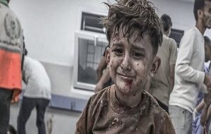 «حکم مرگ تدریجی» ۲۰۰ هزار مجروح غزه چگونه امضا می‌شود
