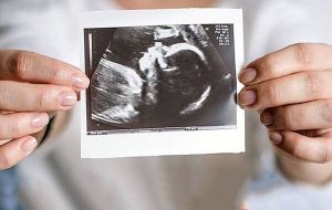 ویزیت رایگان مادران باردار ادامه دارد