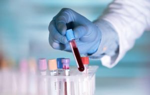 تاثیر آزمایش خون مبتنی بر DNA بر درمان سرطان گلو