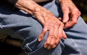مشکل هورمون درمانی برای بیماران جراحی مفصل زانو