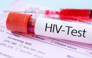 مهم‌ترین چالش امروز HIV در ایران