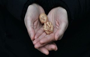 ۱۵ درصد بارداریها به صورت خود به خودی سقط میشوند ۱۵ درصد بارداریها به صورت خود به خودی سقط میشوند